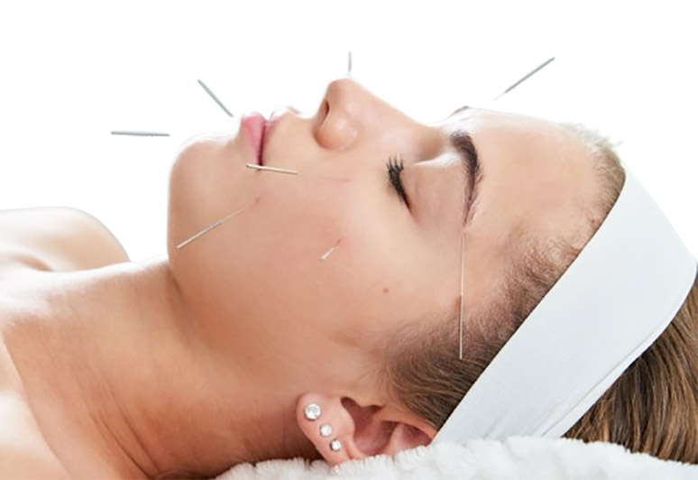 Acupuncture facial